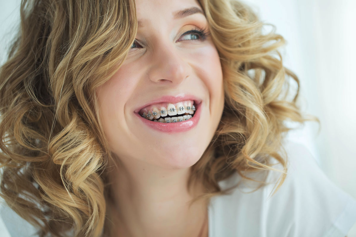 vendita calda online vasta selezione di ottenere a buon mercato L'importanza del sorriso: come correggere i denti storti con l ... vendita calda online vasta selezione di ottenere a buon mercato L'importanza del sorriso: come correggere i denti storti con l ...