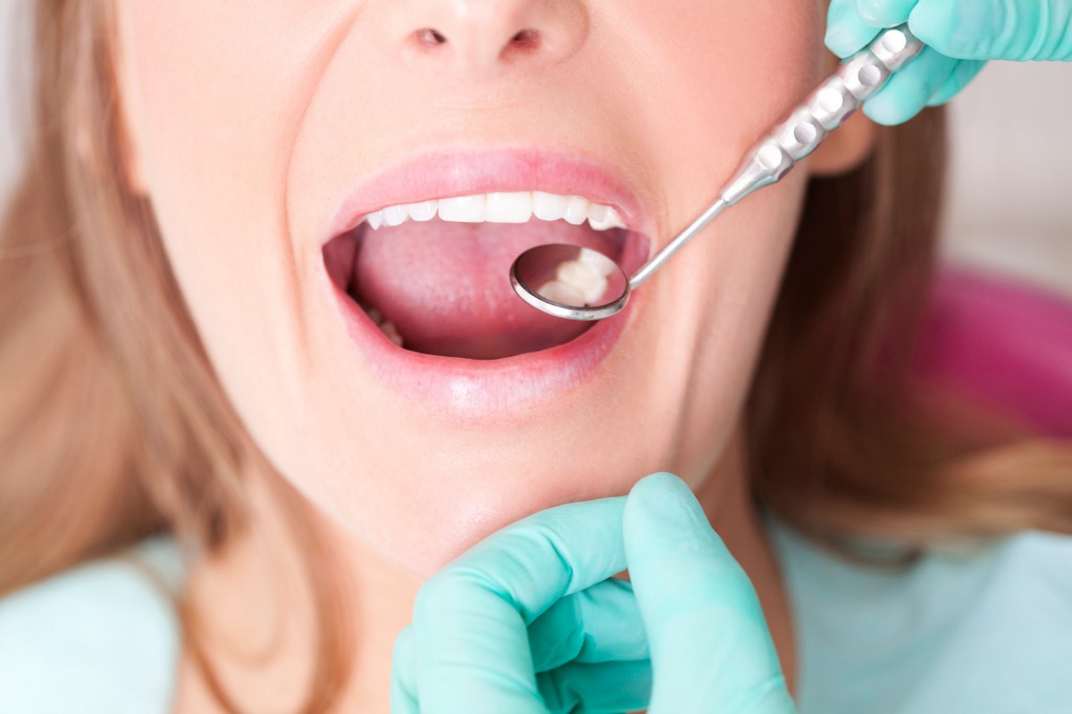è Normale Che I Denti Si Muovono Un Pò